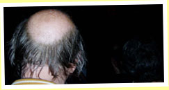 PROCOL HARUM